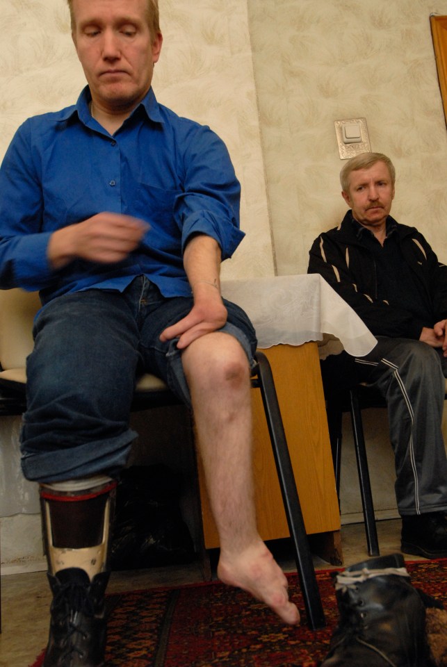 Sergei Zubritsky was born with missing or deformed limbs in a city near the test site