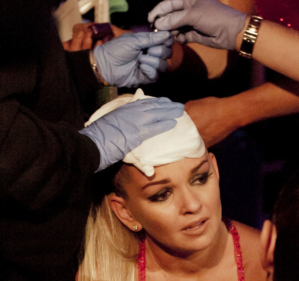 Jennifer Ellison suffered a horrific head injury in 2012