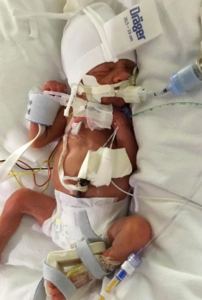 Ayla-Grace was born weighing less than a bag of sugar at just 1lb 15oz