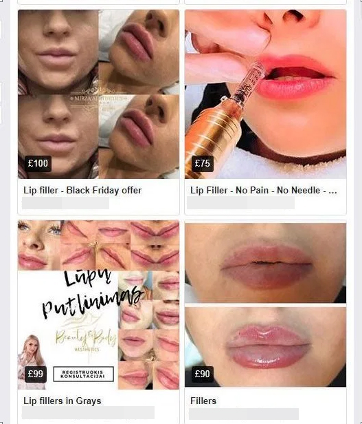 Facebook Marketplace adverts for lip fillers, featuring 'before-and-after' pictures, stock images and special offers