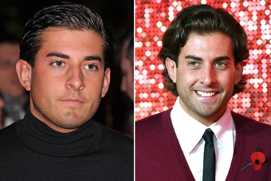 James Argent, known as Arg, had a nose job after being bullied