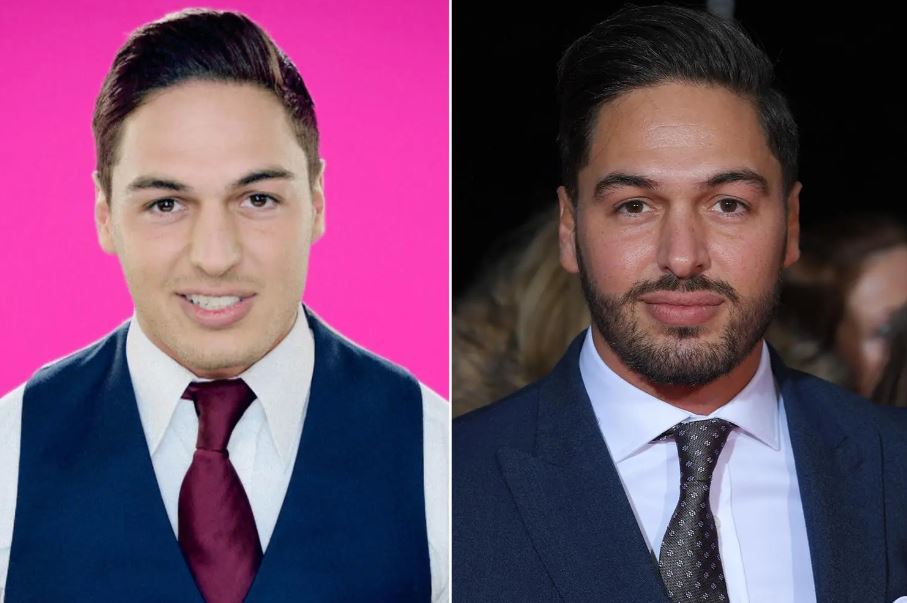 Mario Falcone's also had a nose job after revealing that cruel comments online got to him