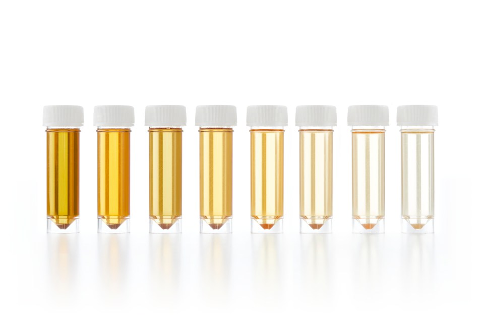 The colour of your urine has a lot to do with your overall health – here’s how to know what’s normal and what’s not