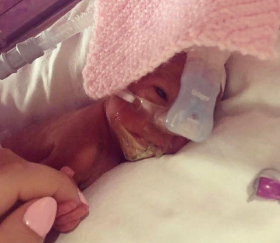 Ayla-Grace underwent open heart surgery and had chronic lung disease in the first few months of her life