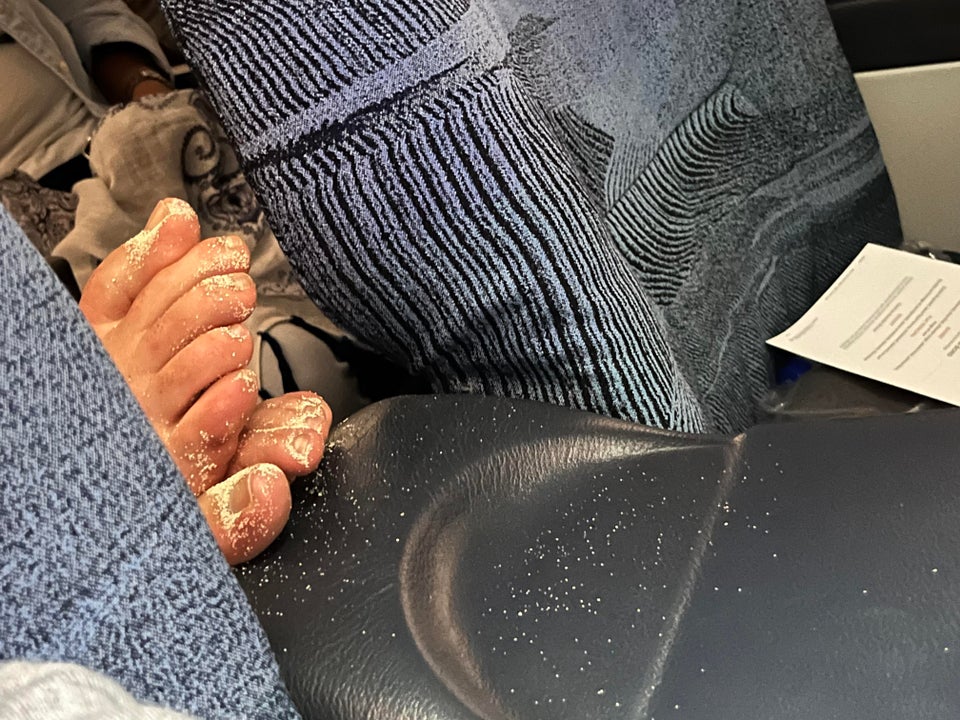 The picture shows the stranger's bare feet on the armrest with a thick dusting of skin on the seat