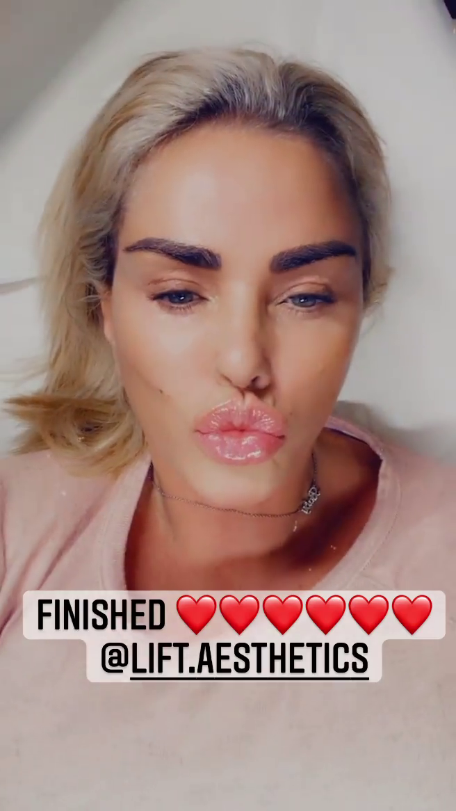 Katie Price showed off her new lips this evening