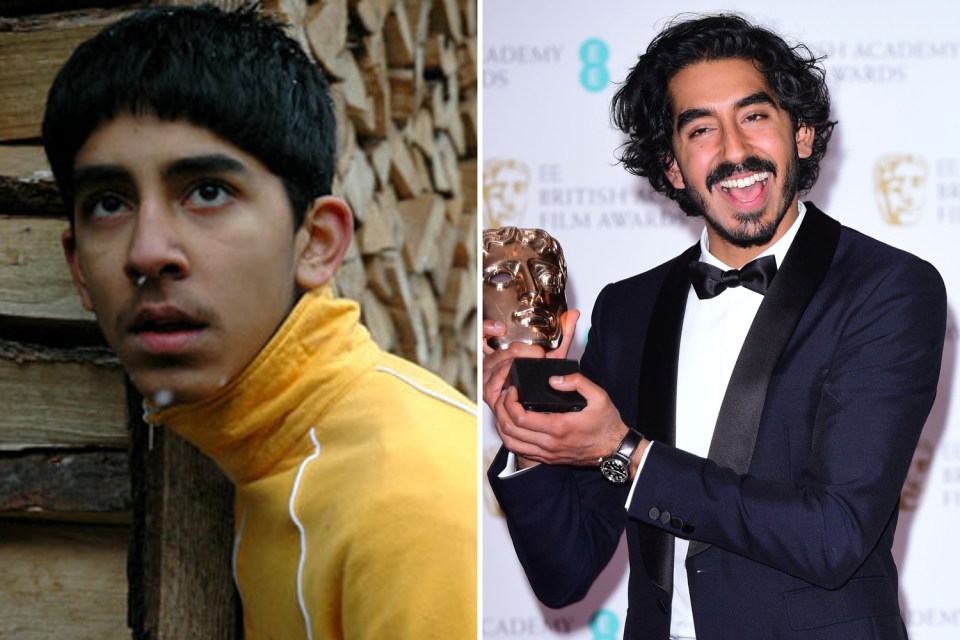 Dev Patel, who played Anwar, stole the show in Slumdog Millionaire