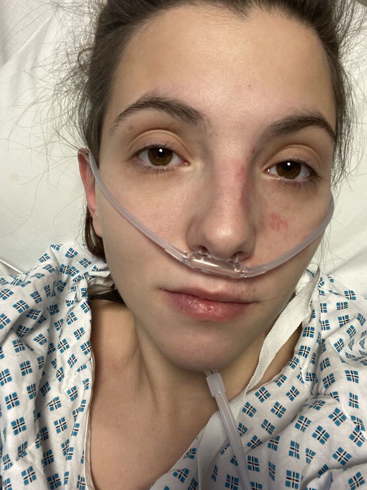 Lauren Perks was in hospital for three days after a Disney glass shattered in front of her face