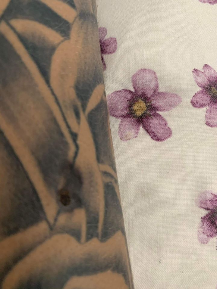 Tom's tattoo artist noticed a mole on his arm at the age of 18 years old