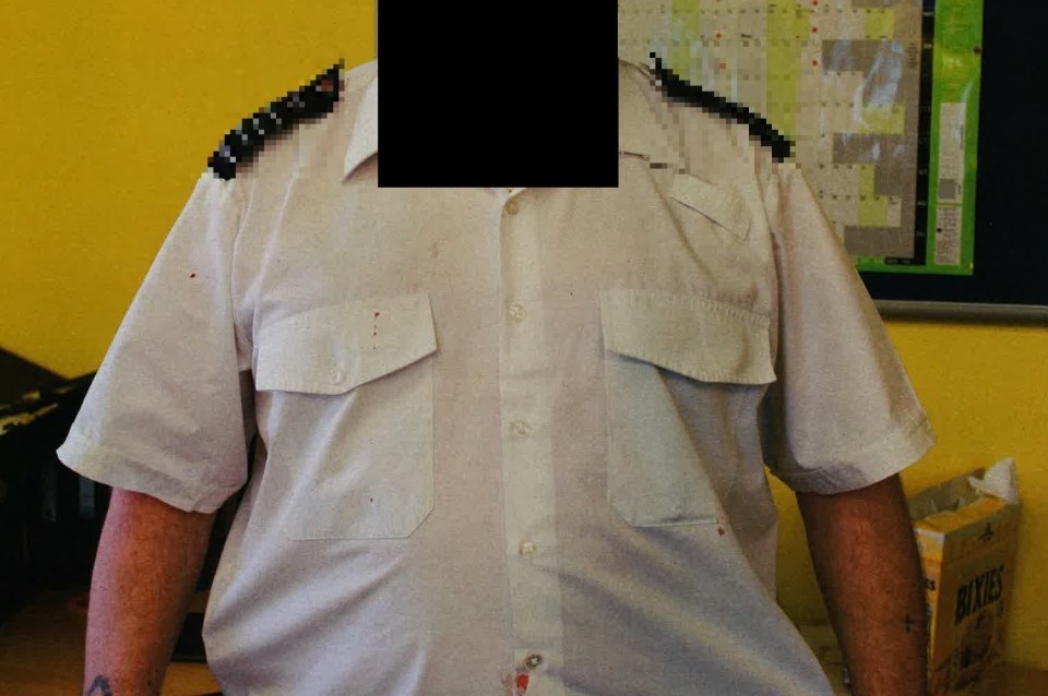 Blood can be seen on his shirt after the attack