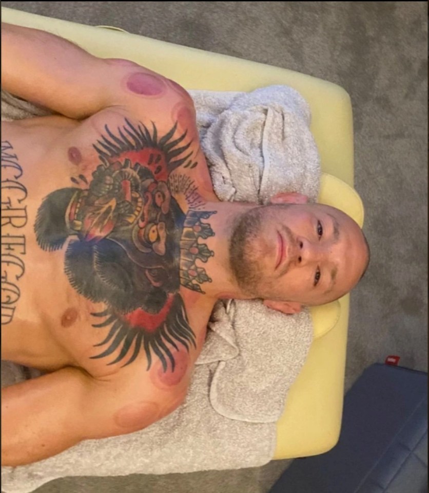 UFC star Conor McGregor is also a regular user of the treatment