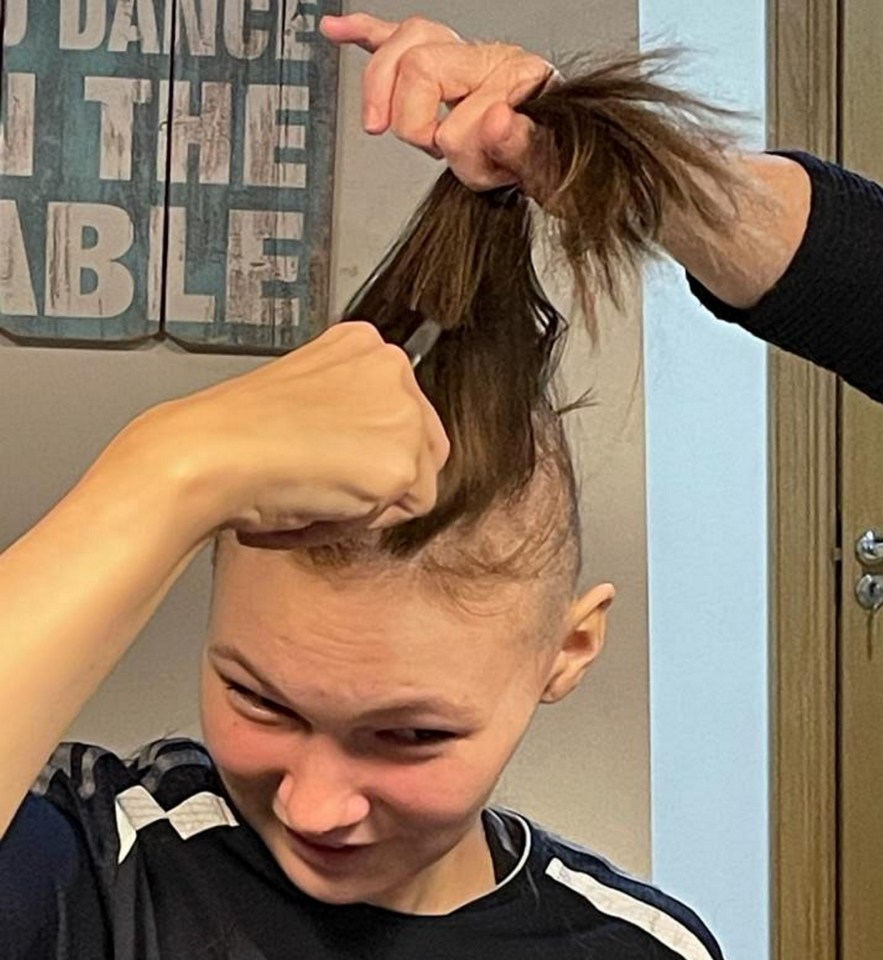 The now 18-year-old lost her hair as a result of the chemotherapy