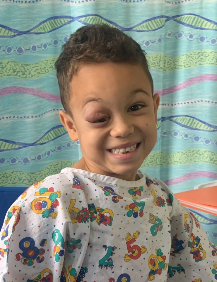 River's eye drooped and bulged before his diagnosis. He's pictured in hospital