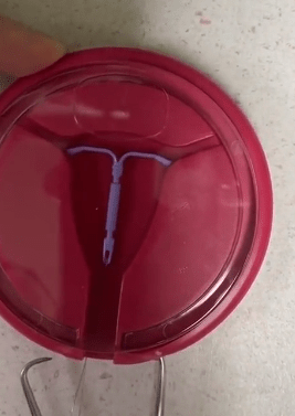 A midwife demonstrated how to insert a coil on a model of a uterus