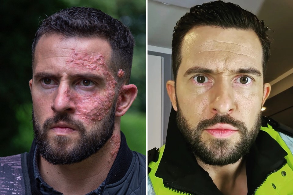 Michael Parr quit Emmerdale for Hollyoaks and is about to star in a US feature film