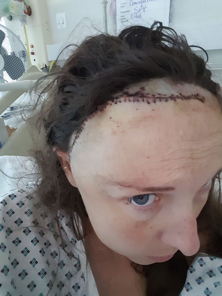 Dominique Nicholson after having major surgery on her brain