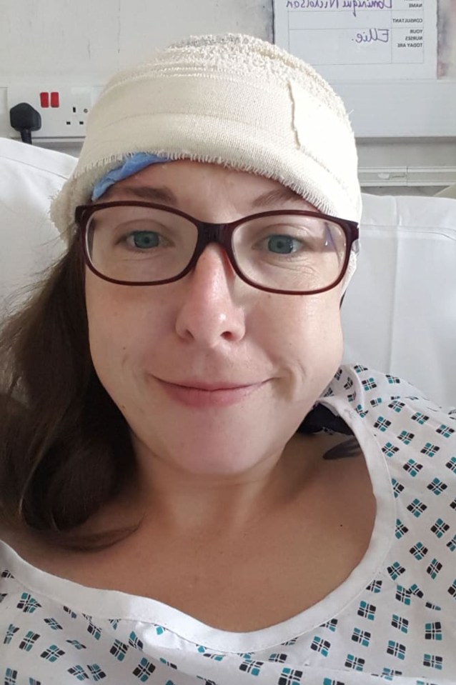 Doctors were able to remove most of her brain tumour