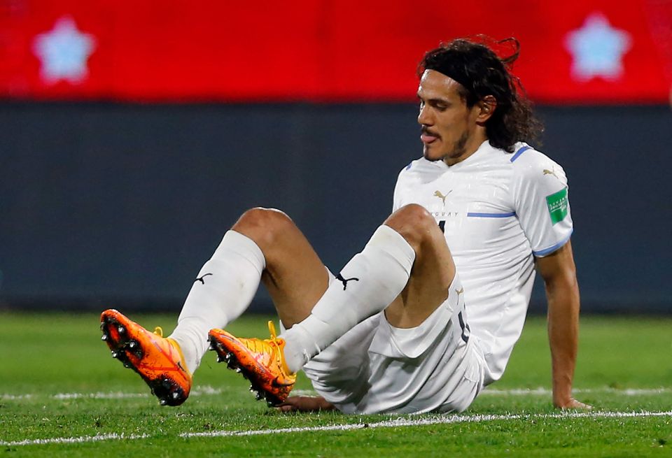 Cavani was forced off just 25 minutes into Uruguay's match against Chile