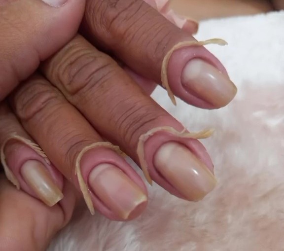 People in the comments section were quick to say that the manicure looked like an infection waiting to happen