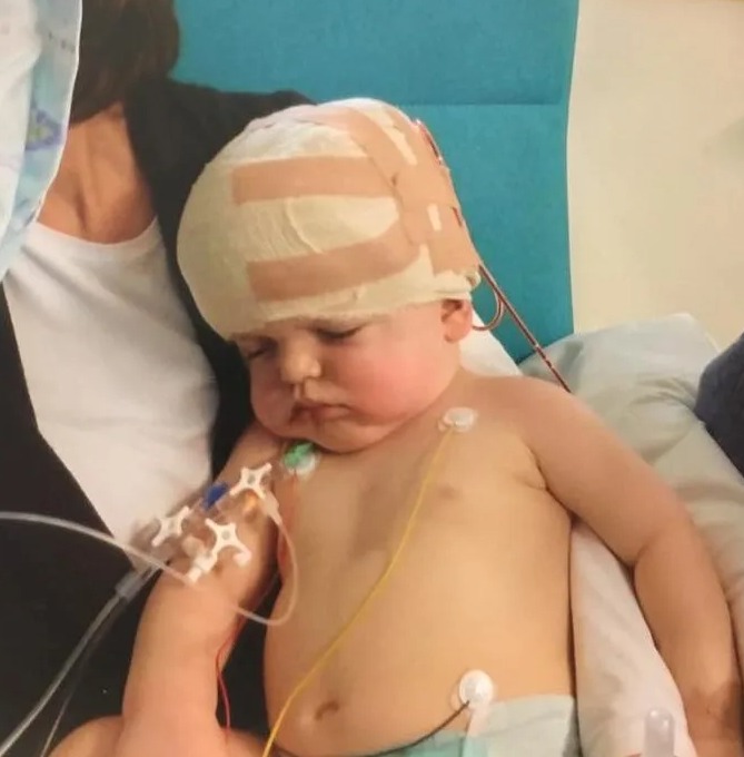 After doctors realised Daniel Bradley's head was too small at birth, he needed life-saving surgery