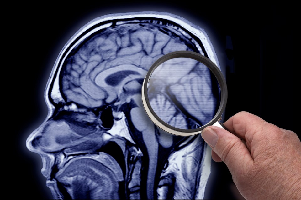 The brain has shown to be infected and harmed by Covid in a number of studies