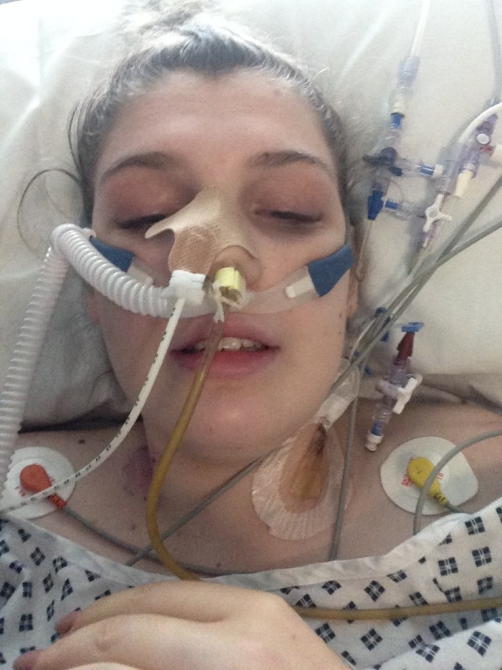 Lucy was put in an induced coma because her injuries were so severe