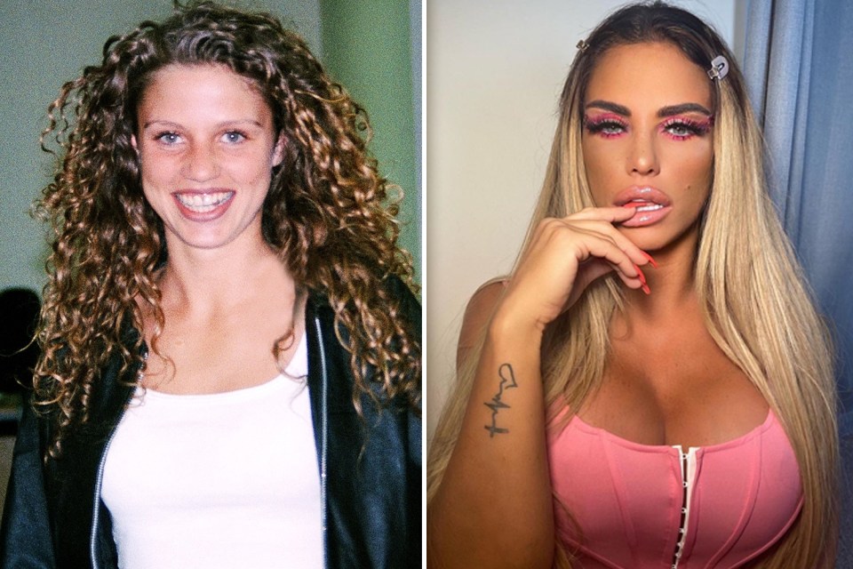 Katie Price has had countless boob jobs and cosmetic procedures