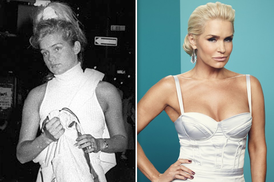 Yolanda Hadid deeply regretted going under the knife as it worsened a deadly health condition