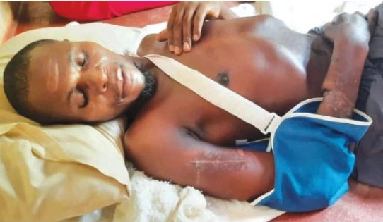 Alexander Chimedza recovering after he escaped from the jaws of death