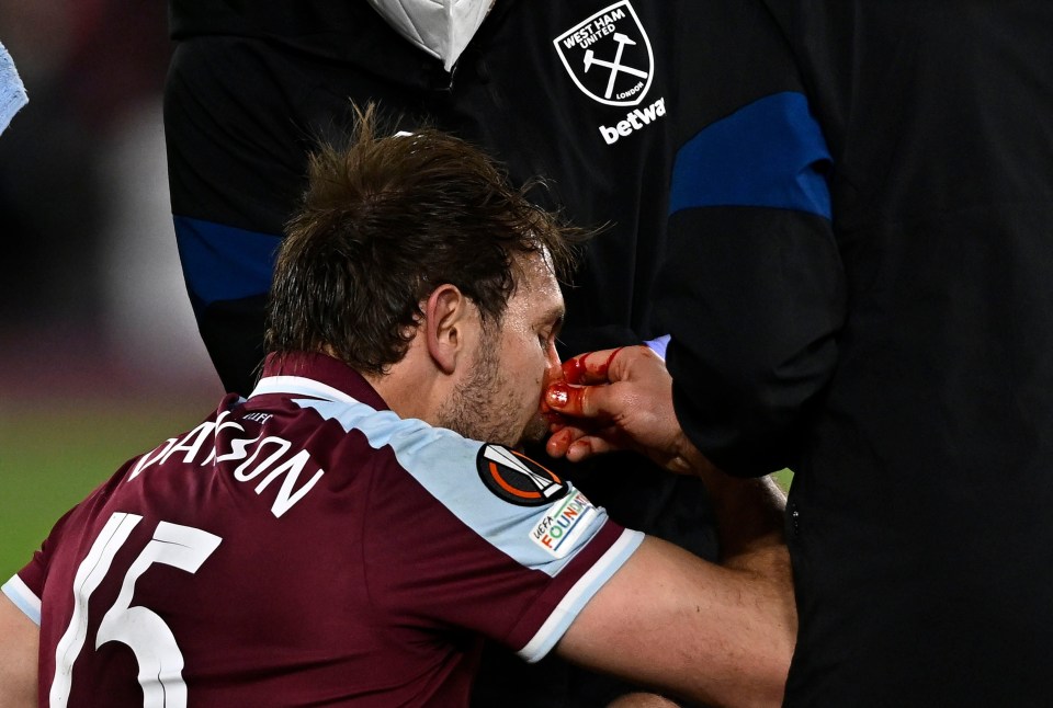 Dawson was also left bloodied in the Hammers' Europa League clash with Lyon on Thursday