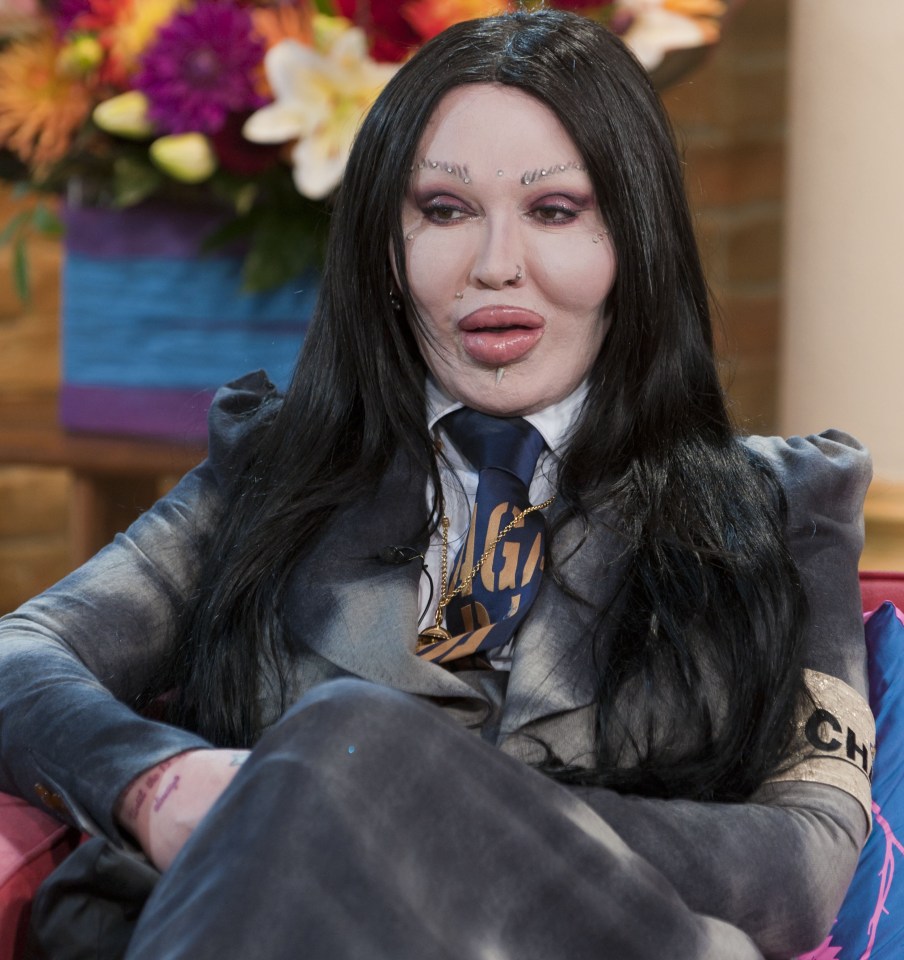 Pete Burns was said to have had more than 300 surgeries, including countless to his face