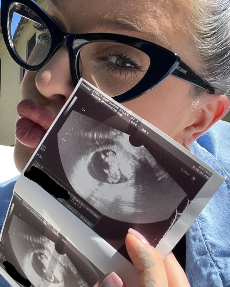 Kelly revealed her pregnancy in an Instagram post