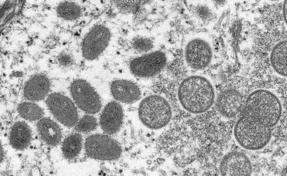 The US, Canada and Spain are among 11 countries to register cases of the virus