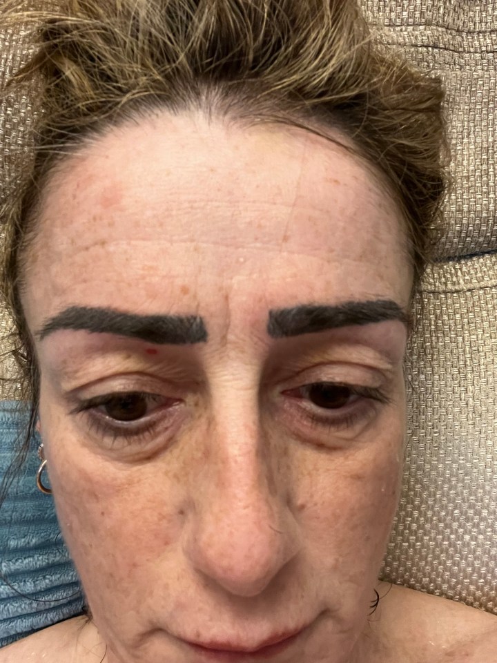 Debbie claimed she's been left with more sparse gaps than before. Pictured, her botched brows