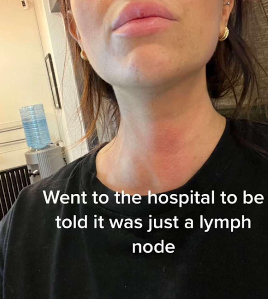 She was diagnosed with cancer just a month after being told by a doctor that a lump on her neck was due to having a cold