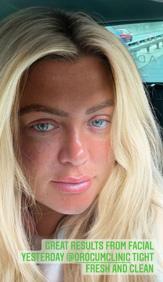 Gemma Collins showed off the results of her 'terrifying' mask treatment