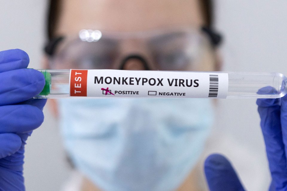 China is planning to cash in big with monkeypox tests and a vaccine