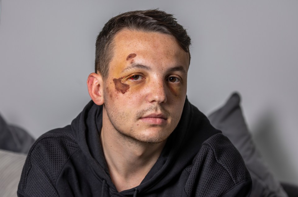 Lewis Morgan says he feared for his life at the hands of armed security guards