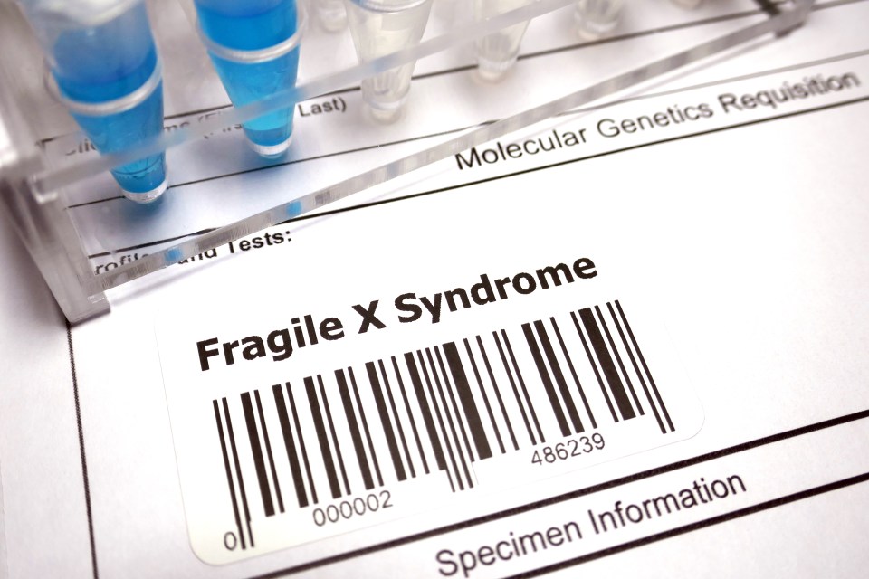 The 37-year-old suffers from the Fragile X syndrome, a rare genetic condition