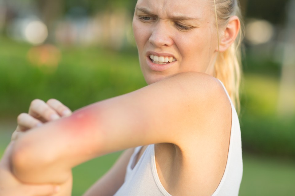 Prevent horrible bites with these top tips