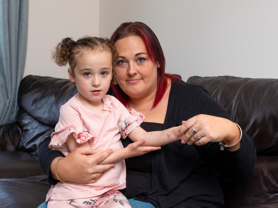 Evie Phillips-Godfrey, 3, almost died from sepsis after being bitten by a cat in the park