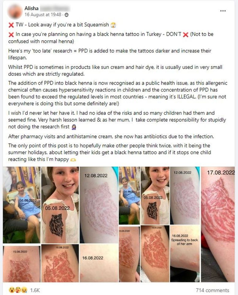 Alisha's Facebook post warning other parents of the risks of black henna tattoos