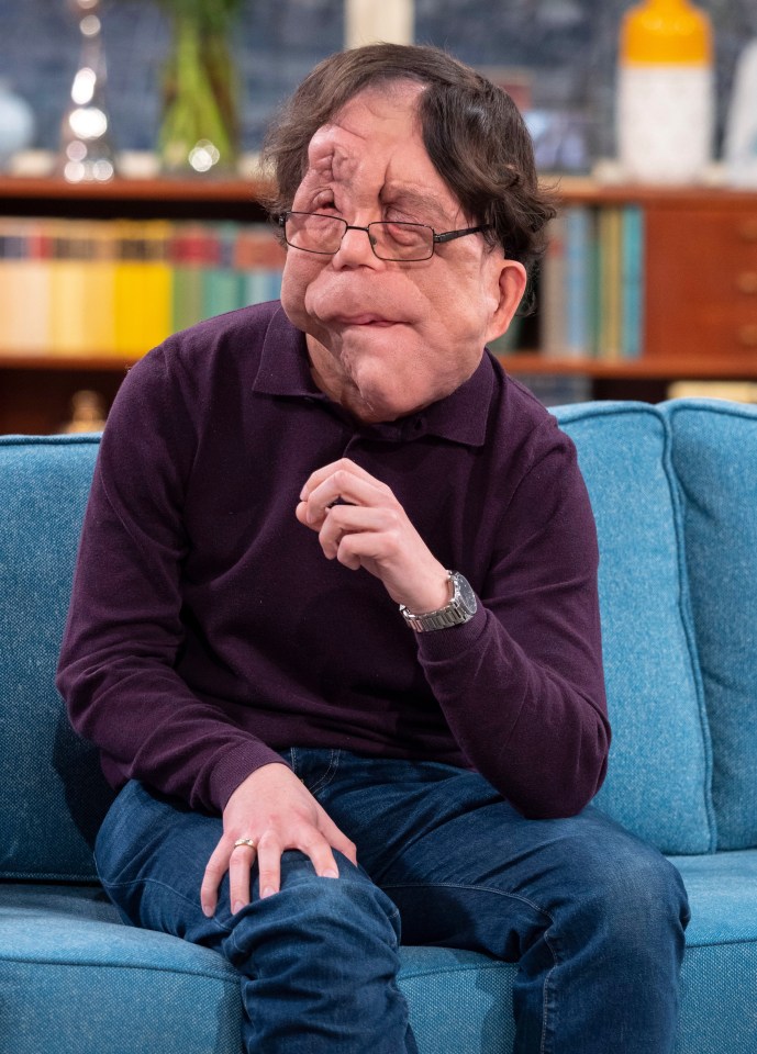 Adam Pearson is a TV star and anti-bullying campaigner