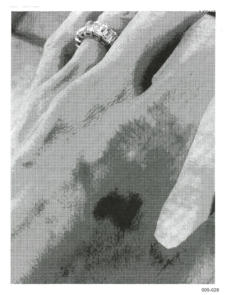 Pictures from the files appear to show injuries on Angelina's hand