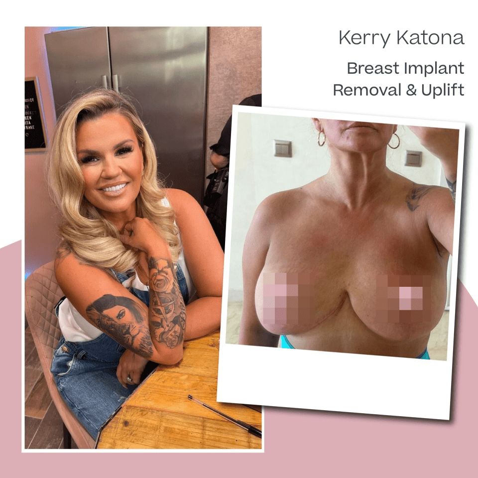 Kerry recently had her boobs uplifted