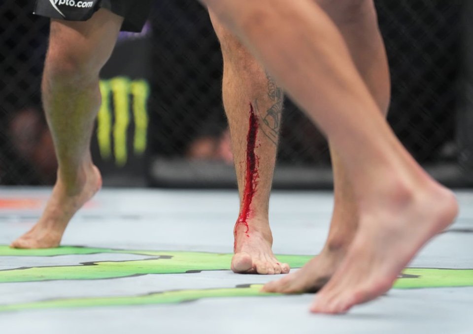 Tony Ferguson suffered a nasty leg gash early on in the fight