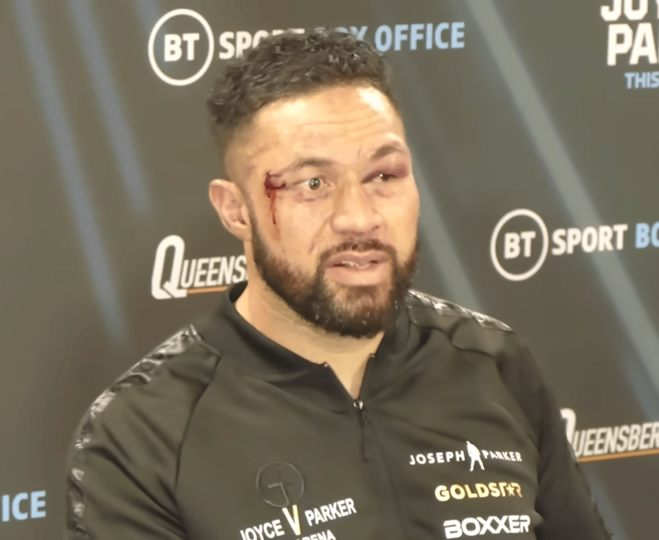 Parker was left battered a bruised after the fight