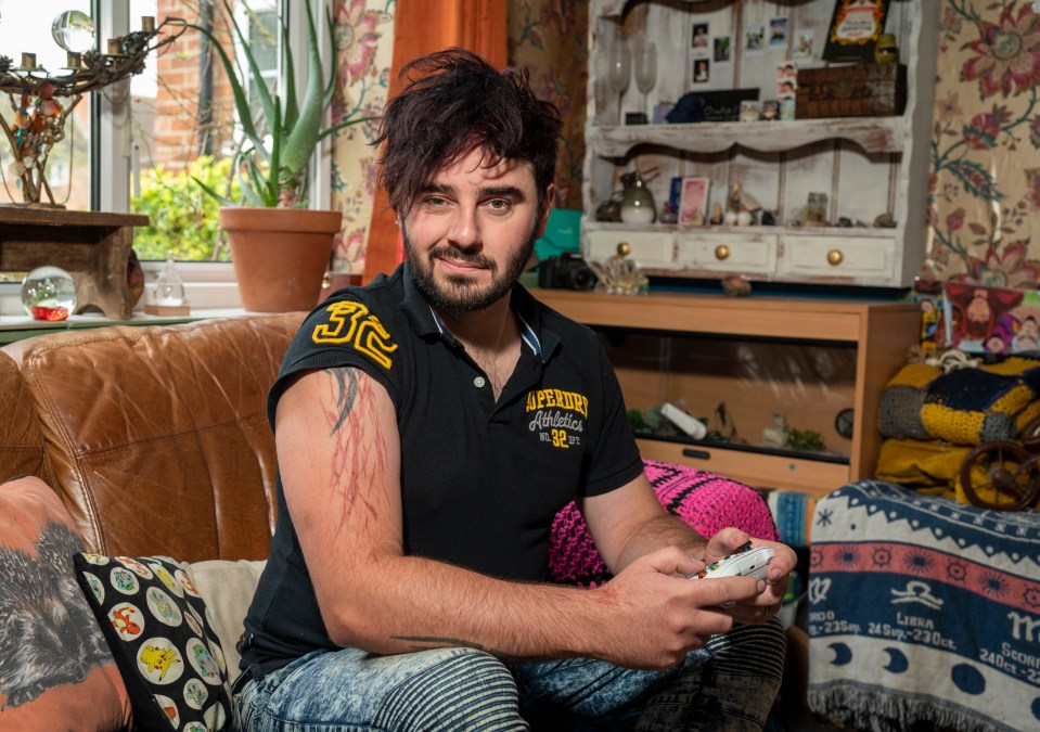 Aidan Rowan had a miracle escape after being struck by lightning as he sat inside on his sofa during a thunderstorm