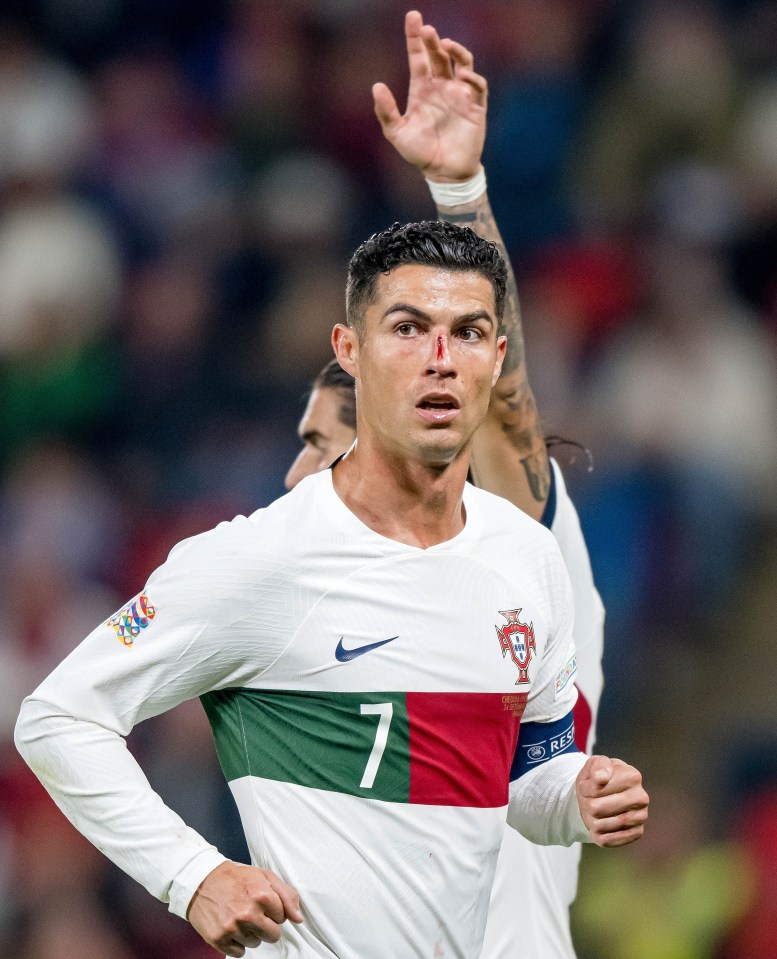 Ronaldo played on with a bloody cut on his nose