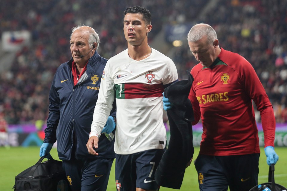 Portugal’s physios managed to stem the flow of blood after the nasty incident